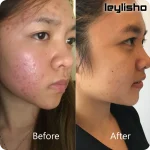 سرم پیلینگ اوردینری برای چی خوبه