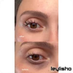تاثیر کرم دور چشم نامبوزین